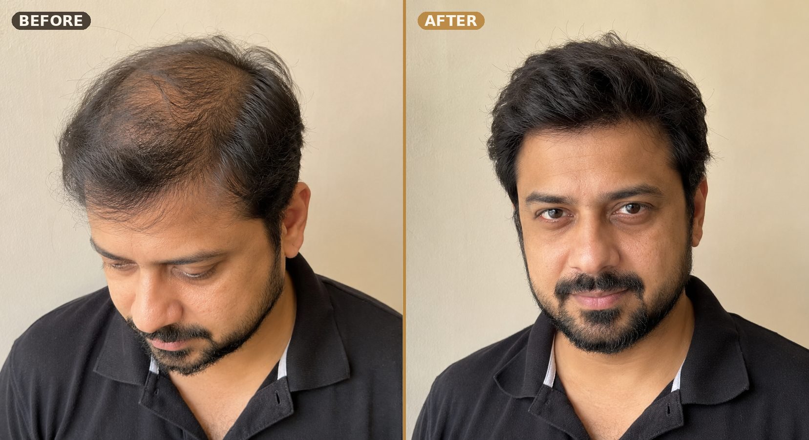 Hairs Hub Studio client before and after transformation